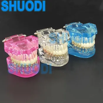 Цельнолитая стоматологическая модель зуба Ортодонтическая модель для общения с пациентом Стоматологический кабинет Клиника Стандартный тип